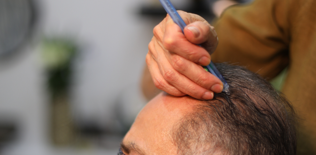 Cheveux d'un homme bénéficiant de la technologie Jet Peel.