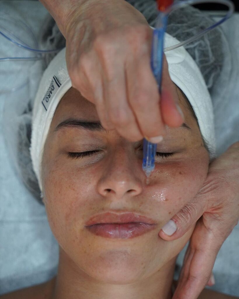 Femme bénéficiant d'un soin du visage JetPeel