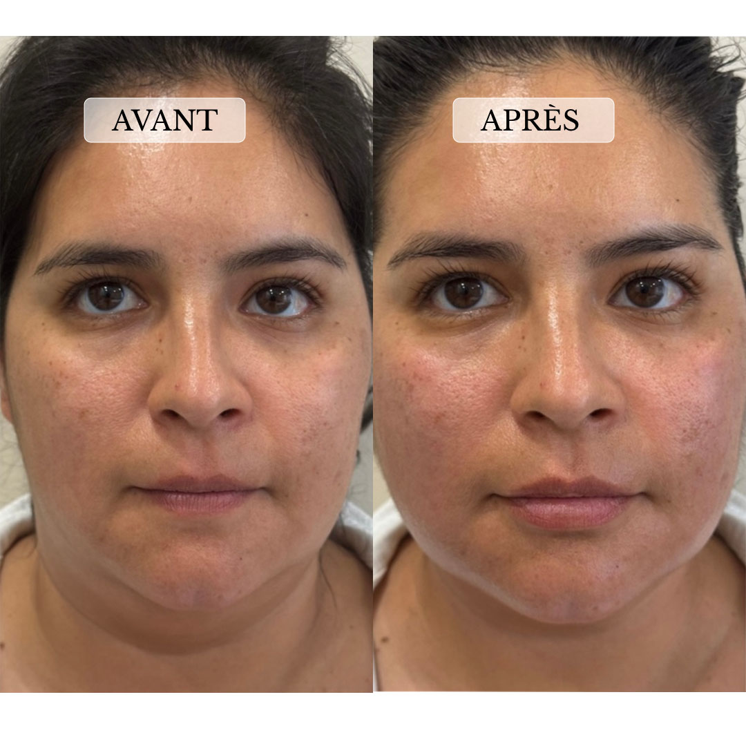 Gommage Pachmina + Gamme nude + Méthode Walking on the Skin™️ + Gua Sha My Jeaneth™️