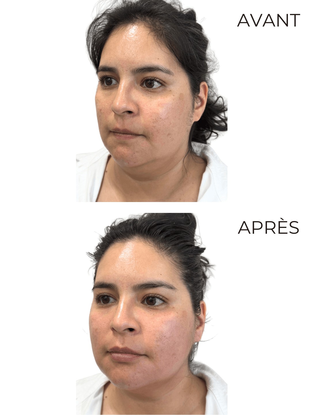 Transformation 2