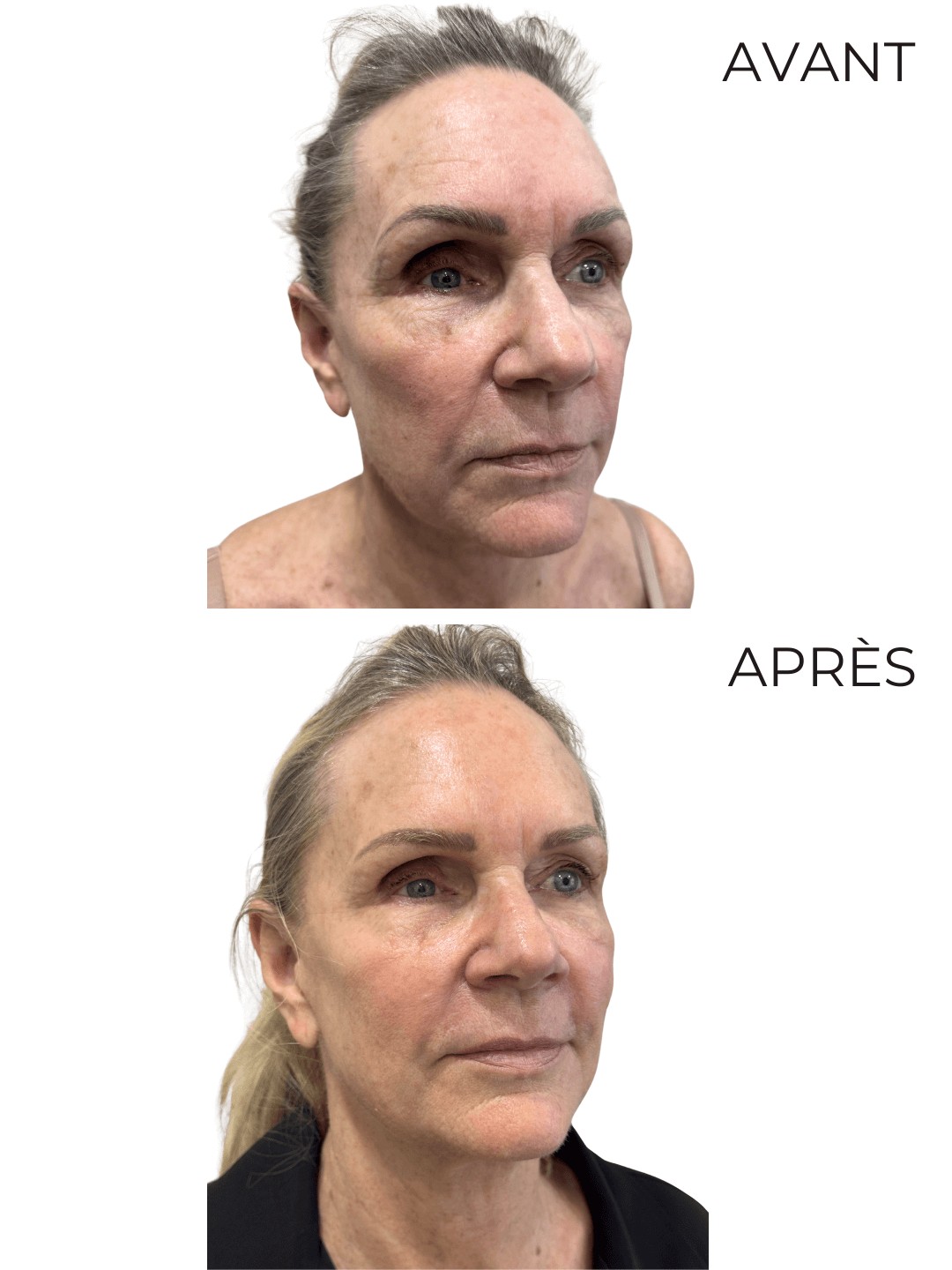 Transformation 5